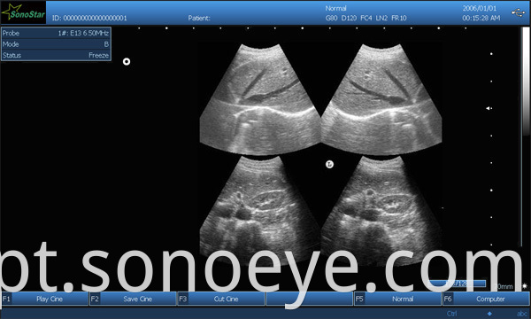 image for labtop ultrasound